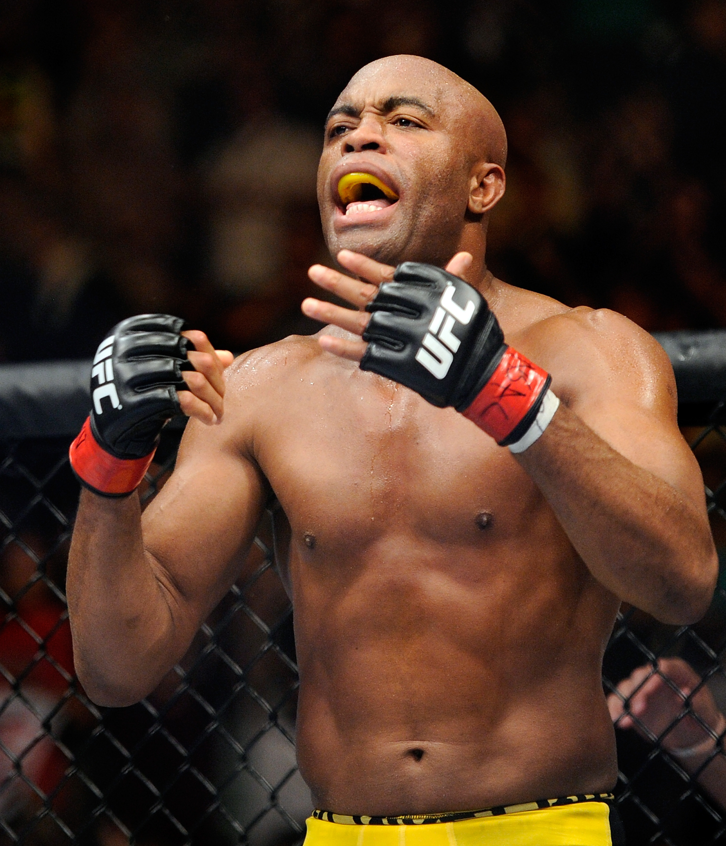 UFC’s Anderson Silva eager to fight again after broken leg | The