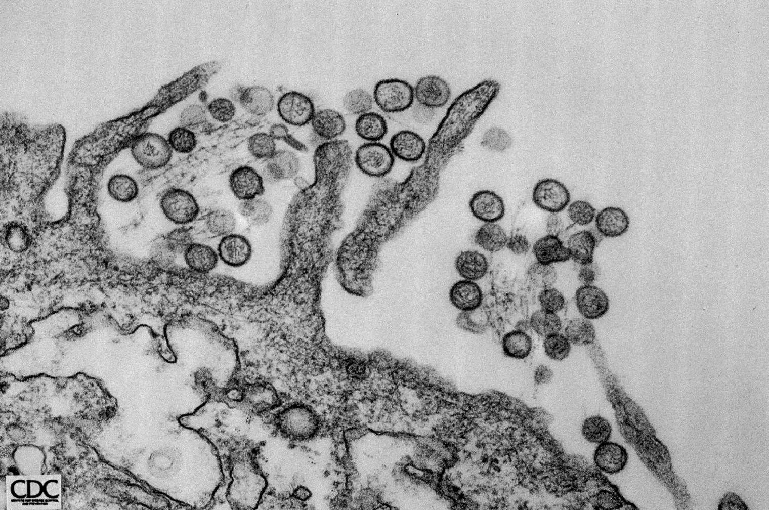 Death of Washington mother of 3 linked to hantavirus | The ...