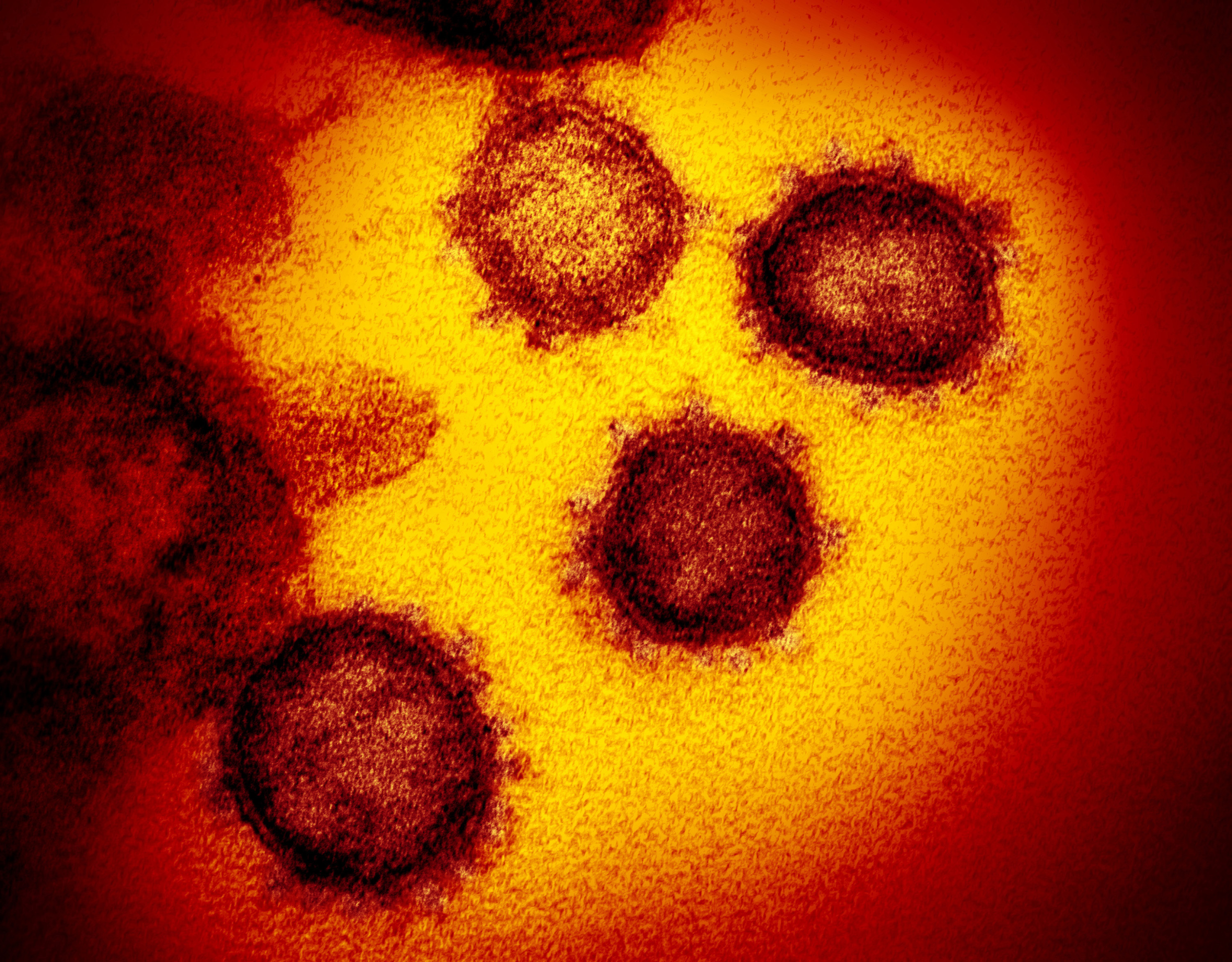 AP source: Rockies star Blackmon tests positive for virus –