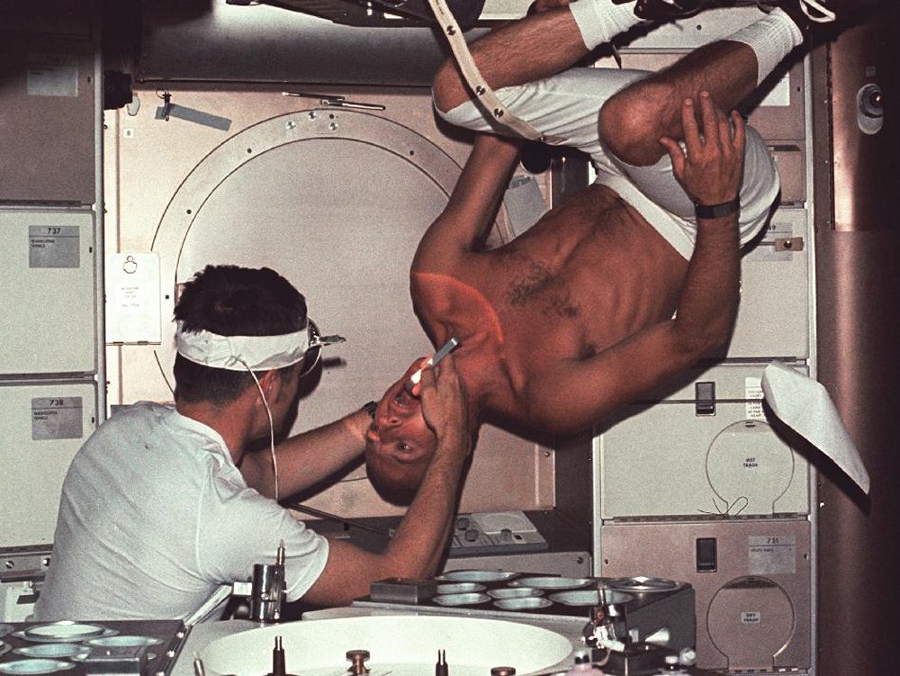 Above: astronaut/ scientist Joseph Kerwin conducts a physical exam of mission commander Pete Conrad on the first crewed mission to Skylab.

Below: Later, the umbrella sunscreen was replaced with a more permanent sunshade for the side of Skylab.